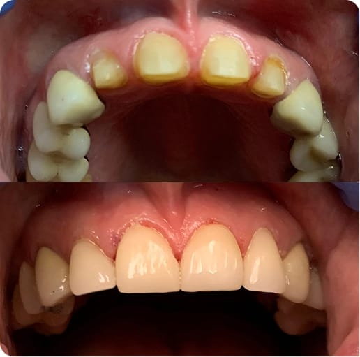Before and After 01