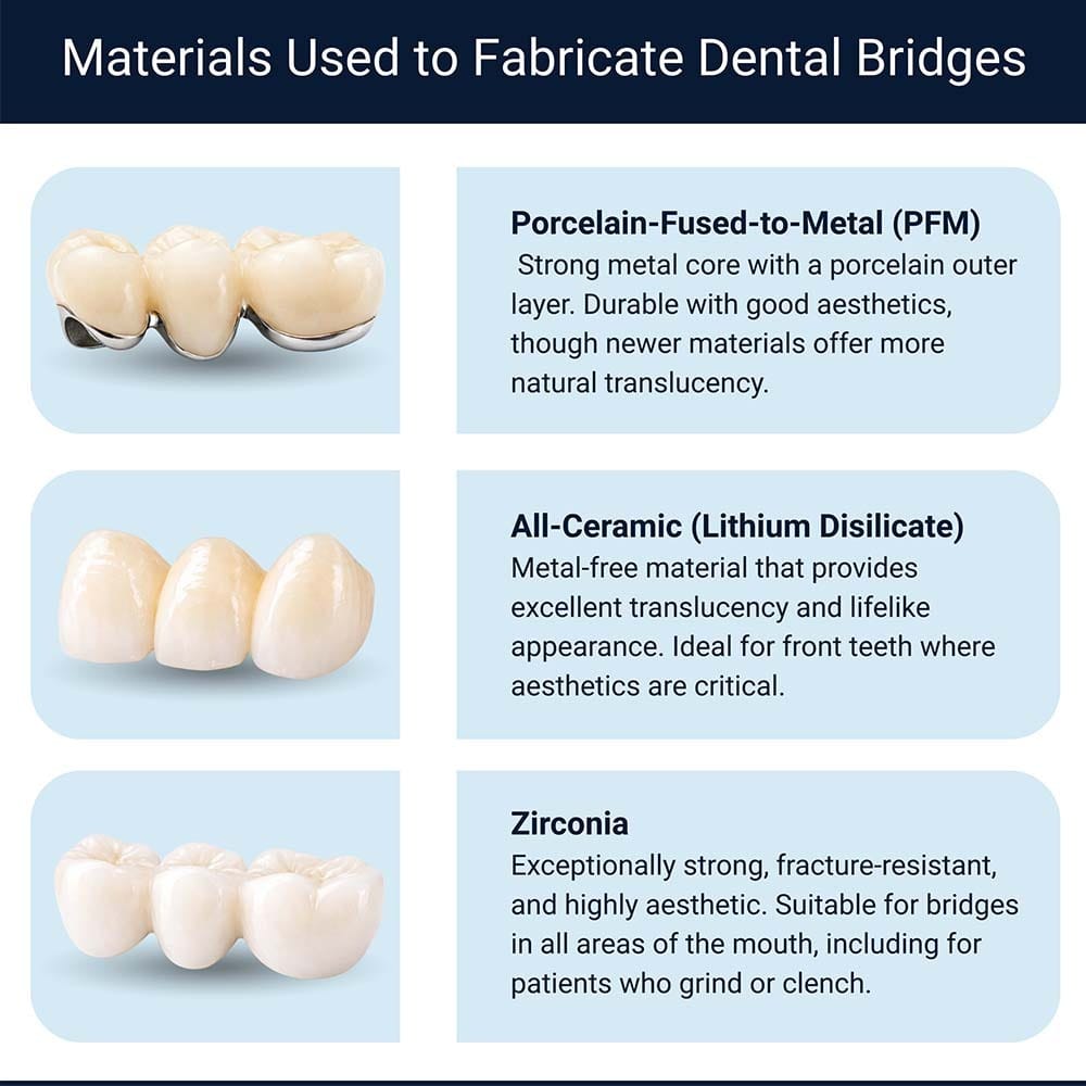 Infographic of dental bridge materials including PFM, lithium disilicate ceramic, and zirconia used by VitaDent Brooklyn Dental Group