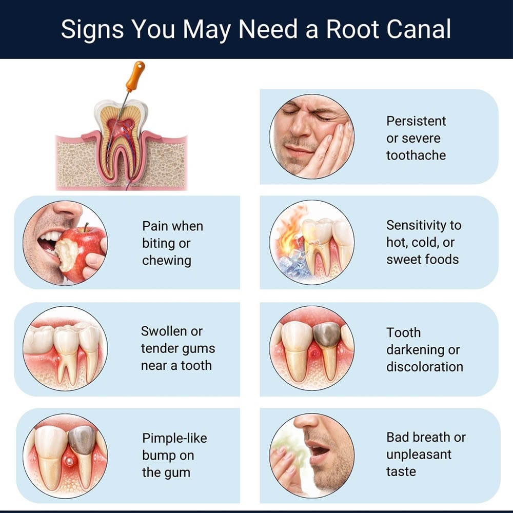 Infographic showing common signs you may need a root canal, including persistent toothache, pain when biting, tooth sensitivity, swollen gums, tooth discoloration, pimple-like gum bump, and bad breath