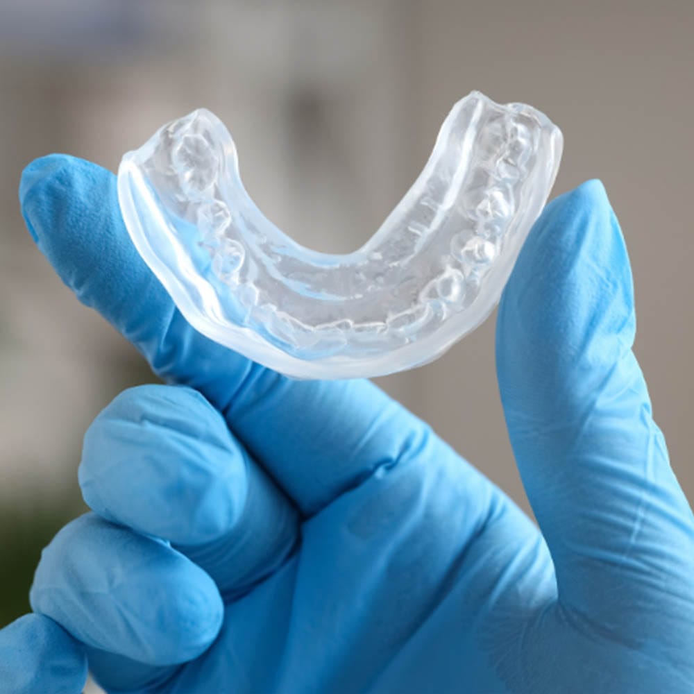Custom dental mouthguard for protecting teeth during sports and dental activities at VitaDent Brooklyn