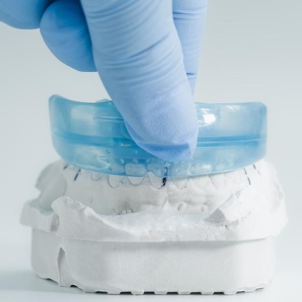 Custom Mouthguards