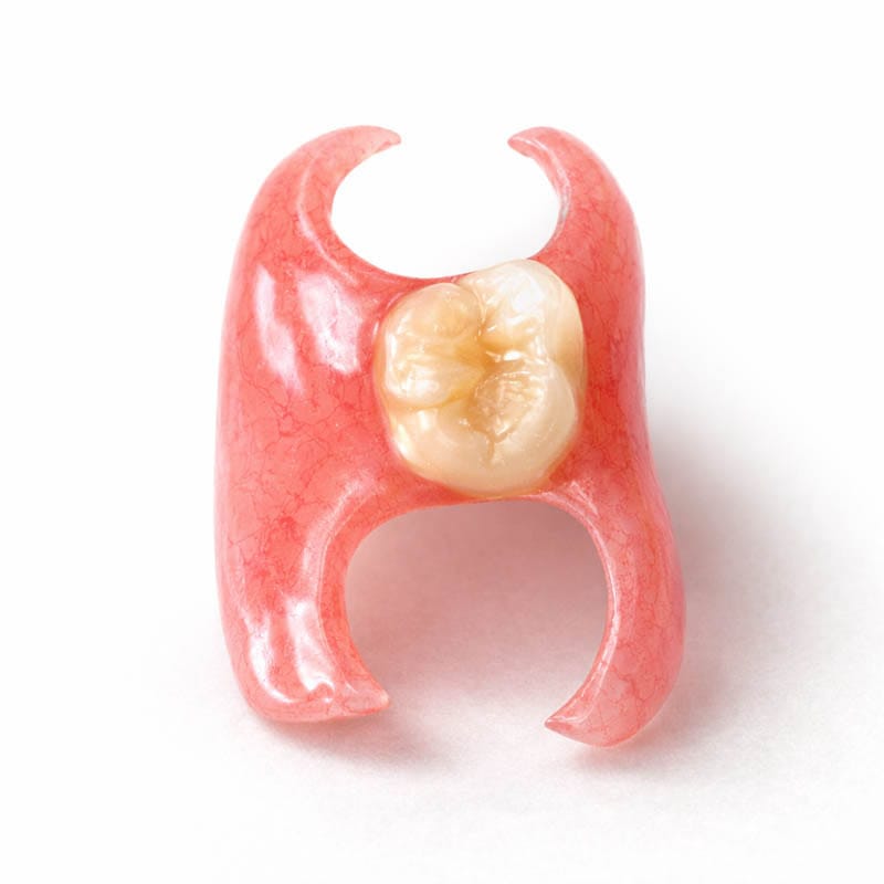High-resolution image of a single-tooth dental flipper with pink acrylic base and natural-looking artificial tooth used as a removable partial denture in Sheepshead Bay, Brooklyn, NY.
