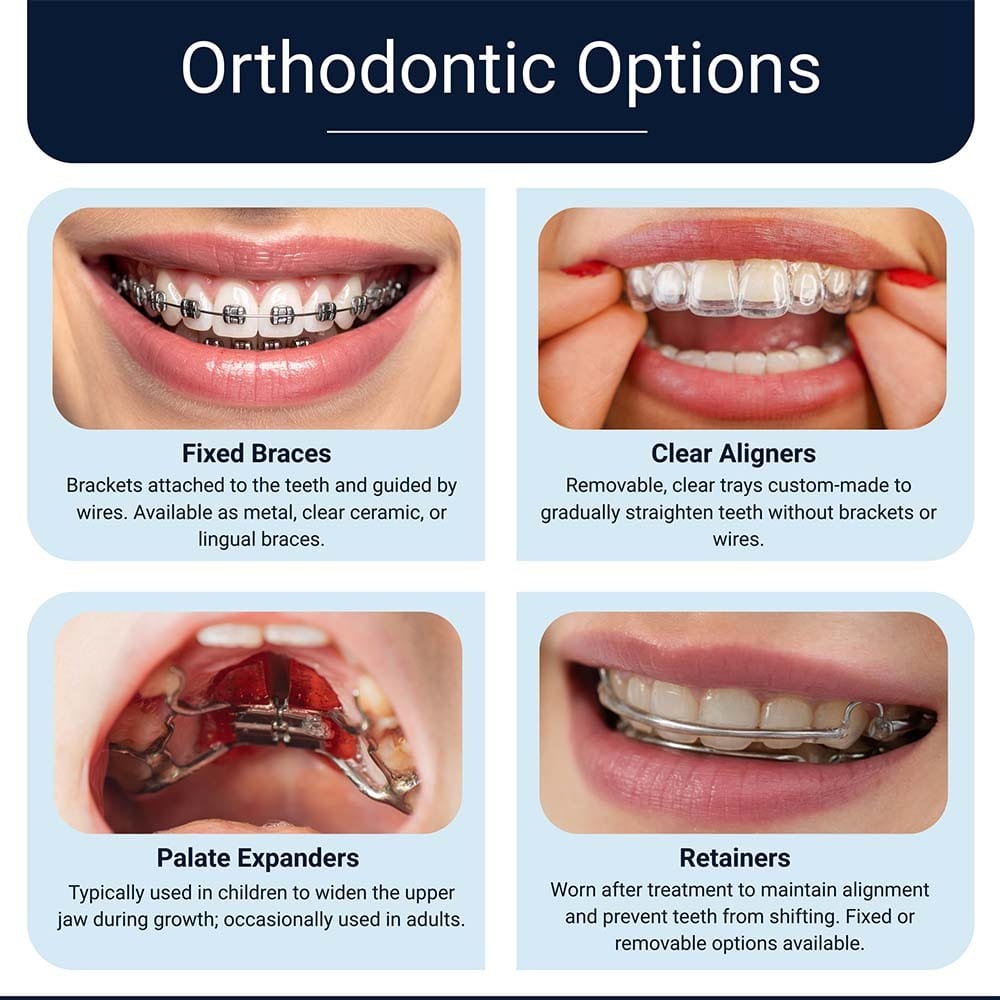 Overview of orthodontic options including fixed braces, clear aligners, palate expanders, and retainers.