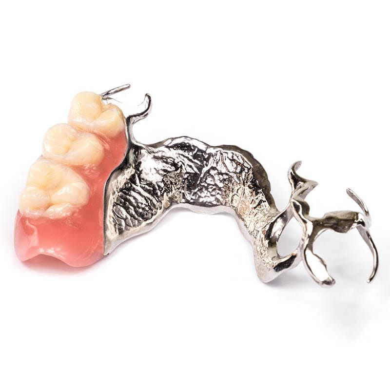 High-resolution image of a removable partial denture with cobalt-chromium metal framework, natural-looking artificial teeth, and pink acrylic gum base for tooth replacement in Brooklyn, NY.