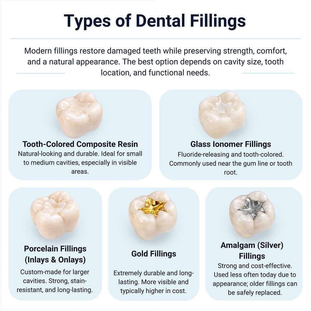 Infographic explaining dental filling options at VitaDent Brooklyn, including composite, porcelain, gold, amalgam, and glass ionomer fillings