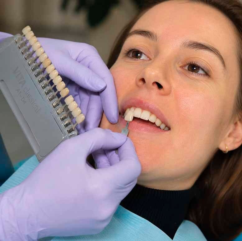 Dental Veneers Sheepshead Bay Brooklyn
